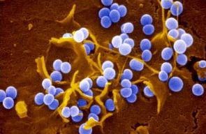 staphylococcusaureus.jpg